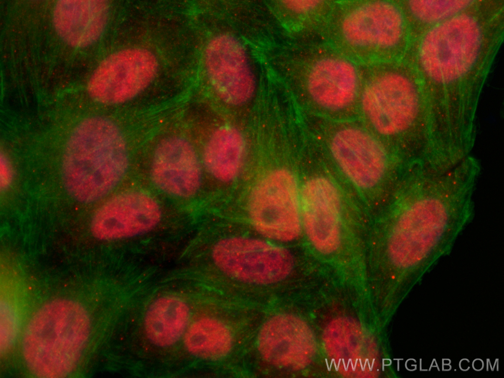 IF Staining of HepG2 using 21215-1-AP