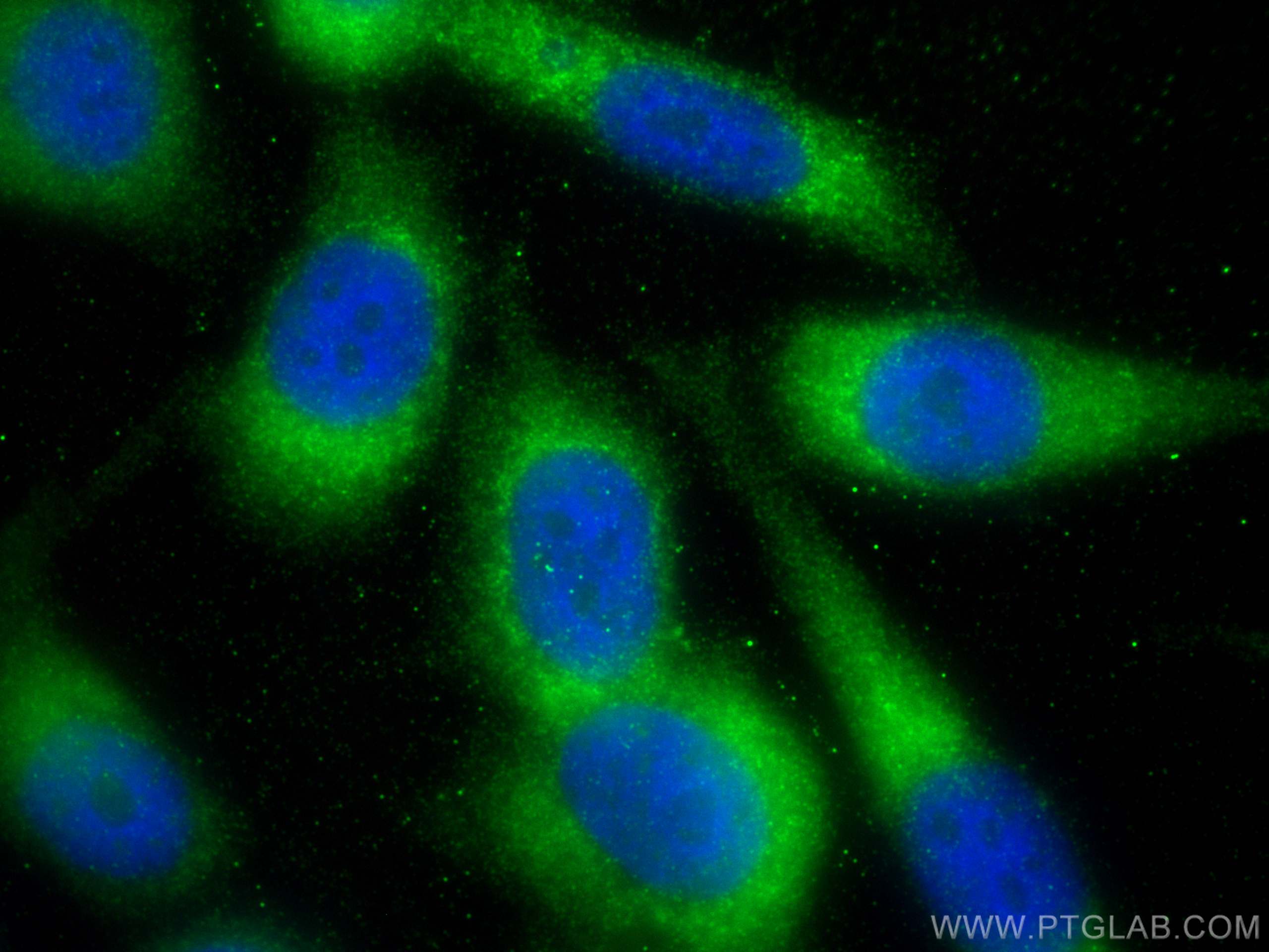 IF Staining of PC-3 using 22641-1-AP