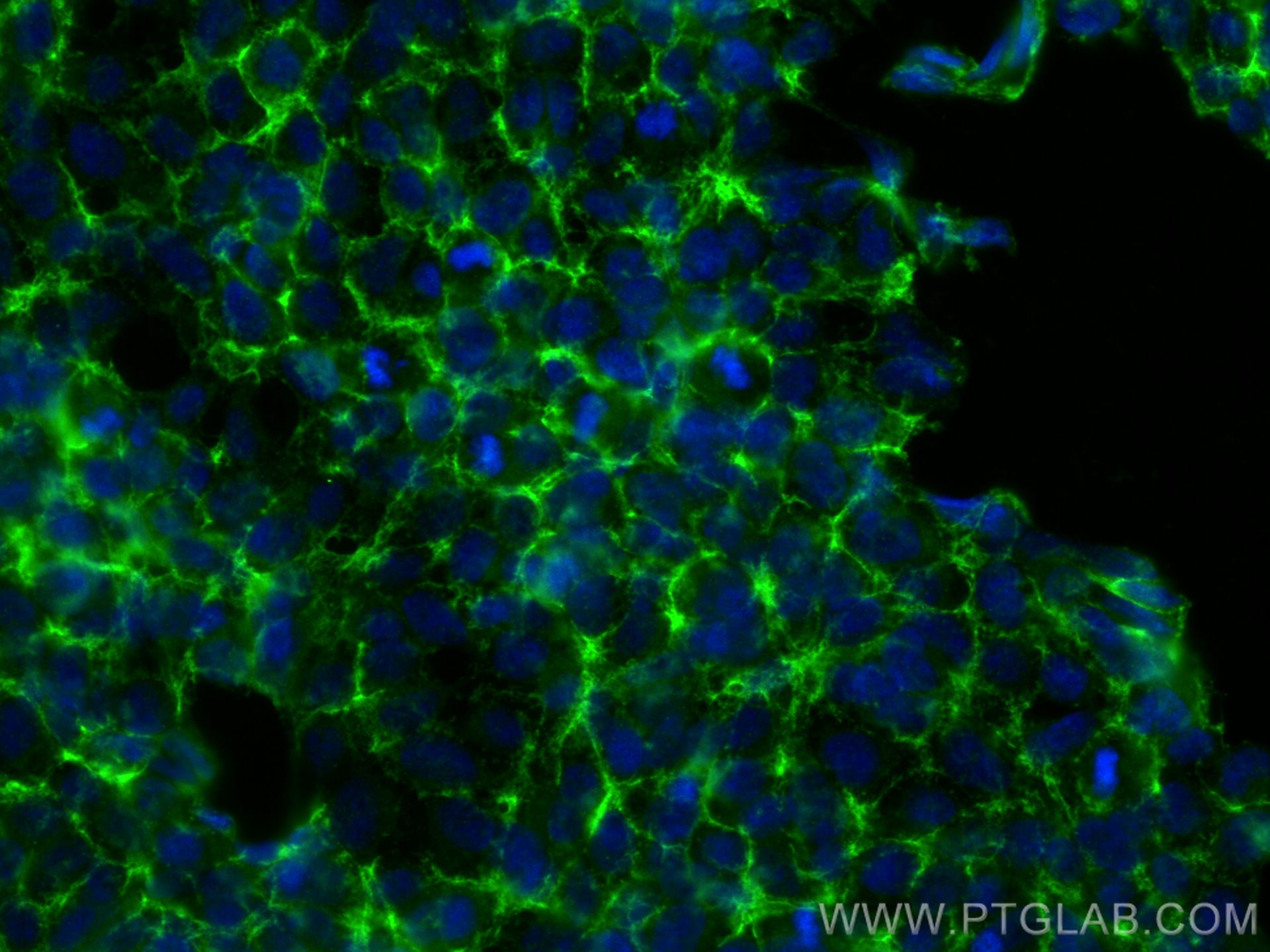 IF Staining of HEK-293 using 13672-1-AP