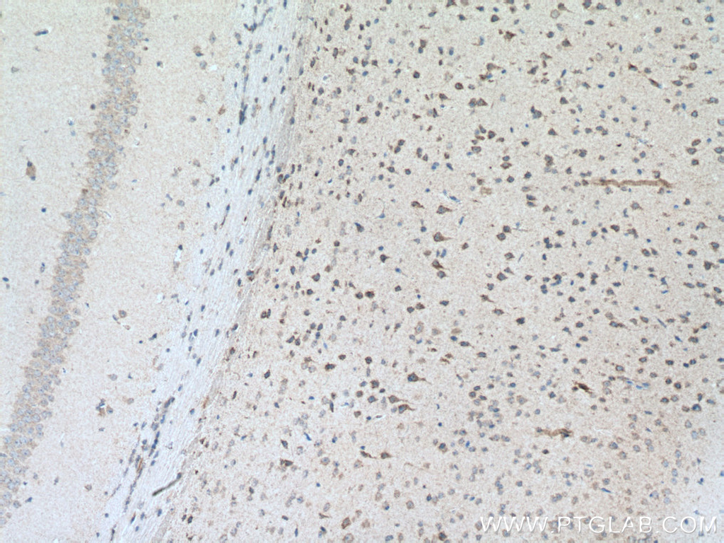 IHC staining of mouse brain using 19141-1-AP