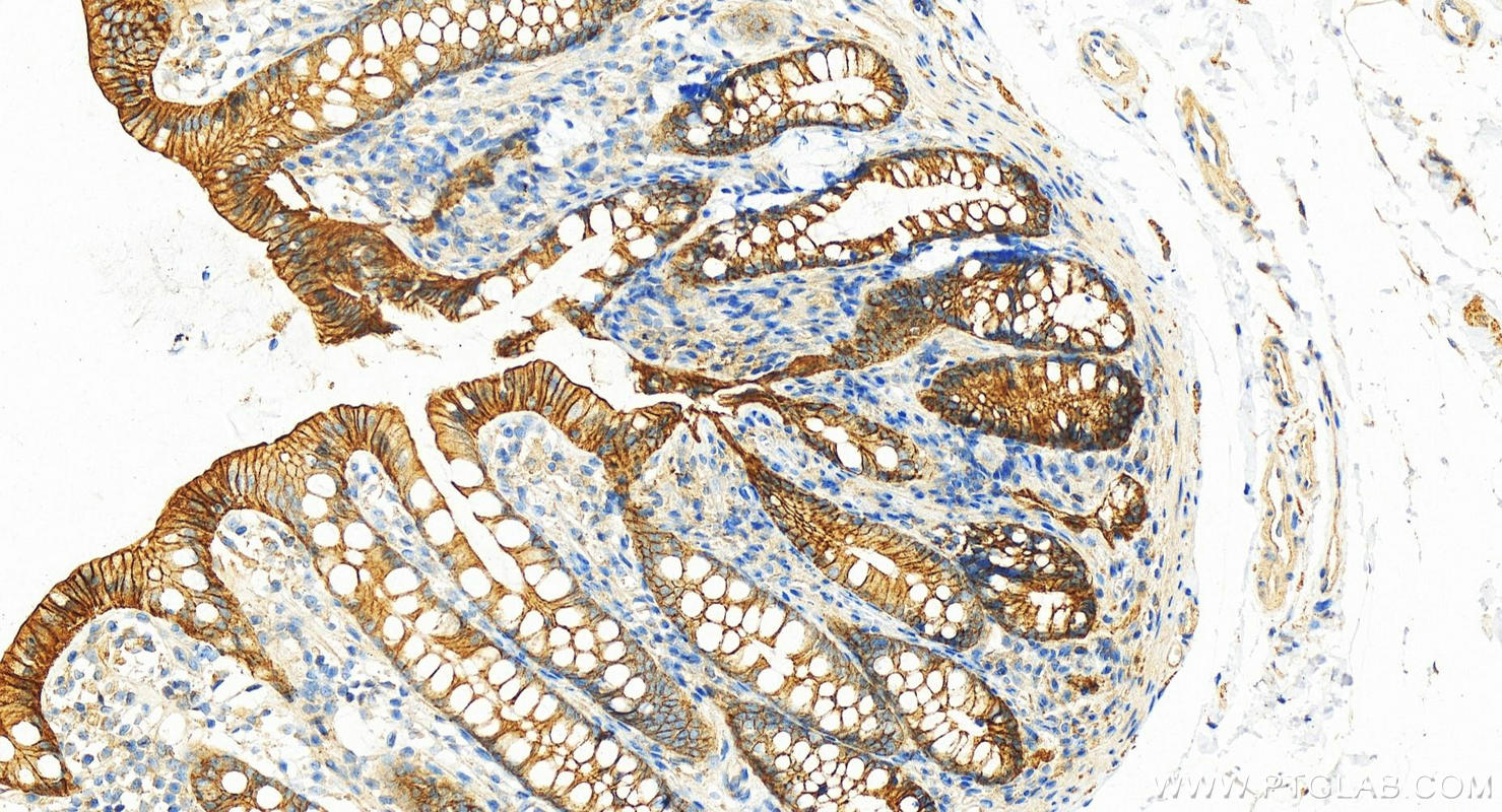 IHC staining of human colon using 14418-1-AP