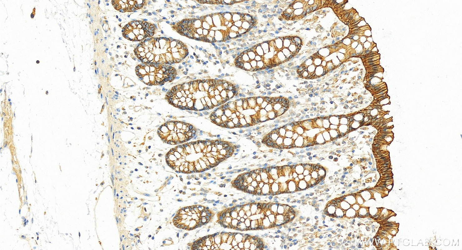 IHC staining of human colon using 14418-1-AP