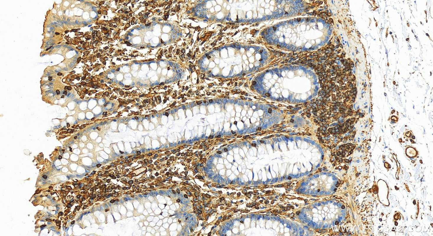 IHC staining of human normal colon using 14418-1-AP