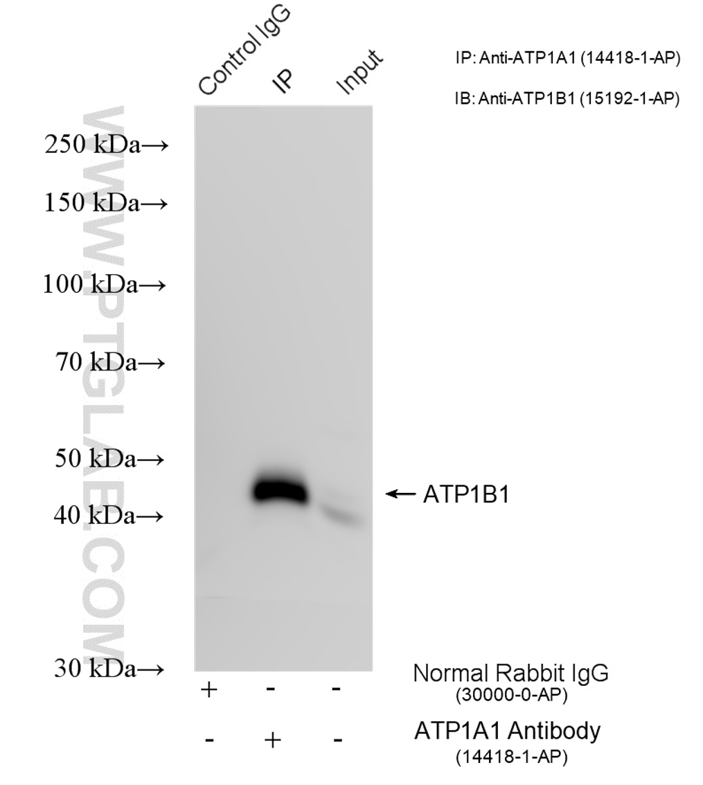 CoIP experiment of A431 using 14418-1-AP