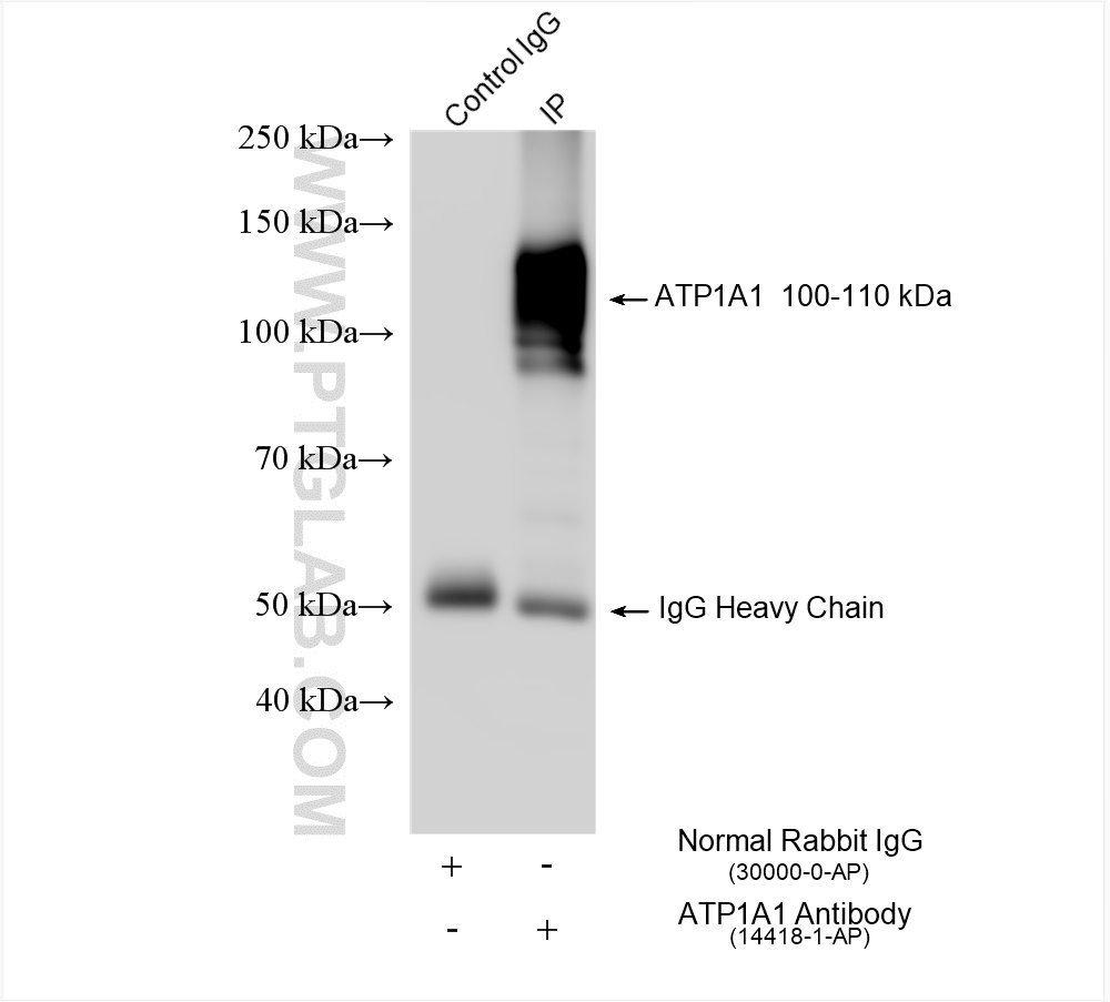 IP experiment of HEK-293 using 14418-1-AP