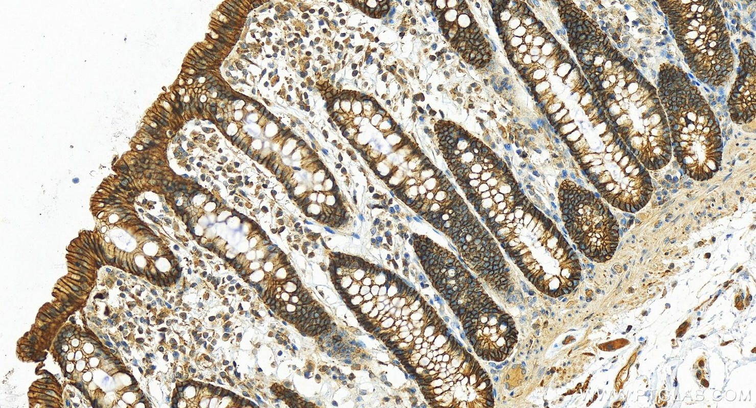 IHC staining of human colon using 55187-1-AP