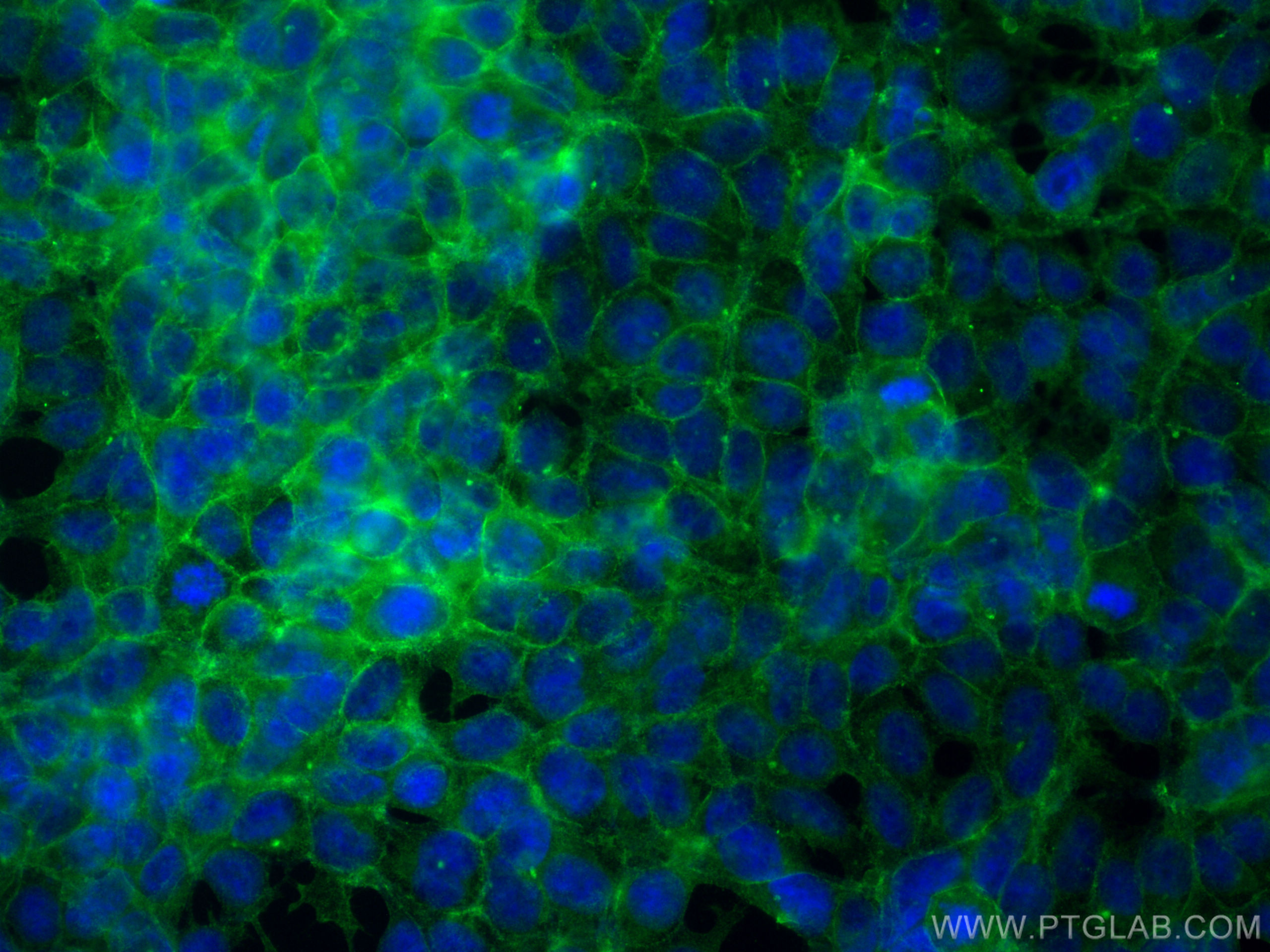 IF Staining of HEK-293 using 68735-2-Ig