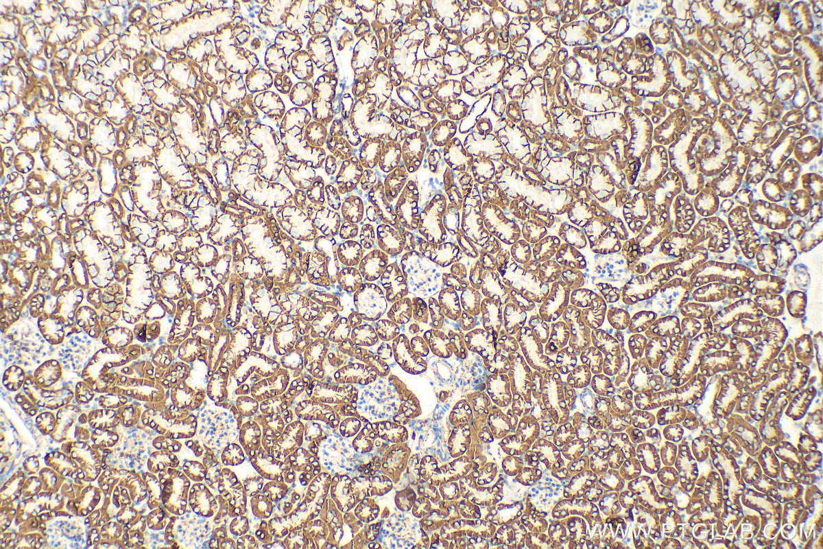 IHC staining of mouse kidney using 68735-2-Ig
