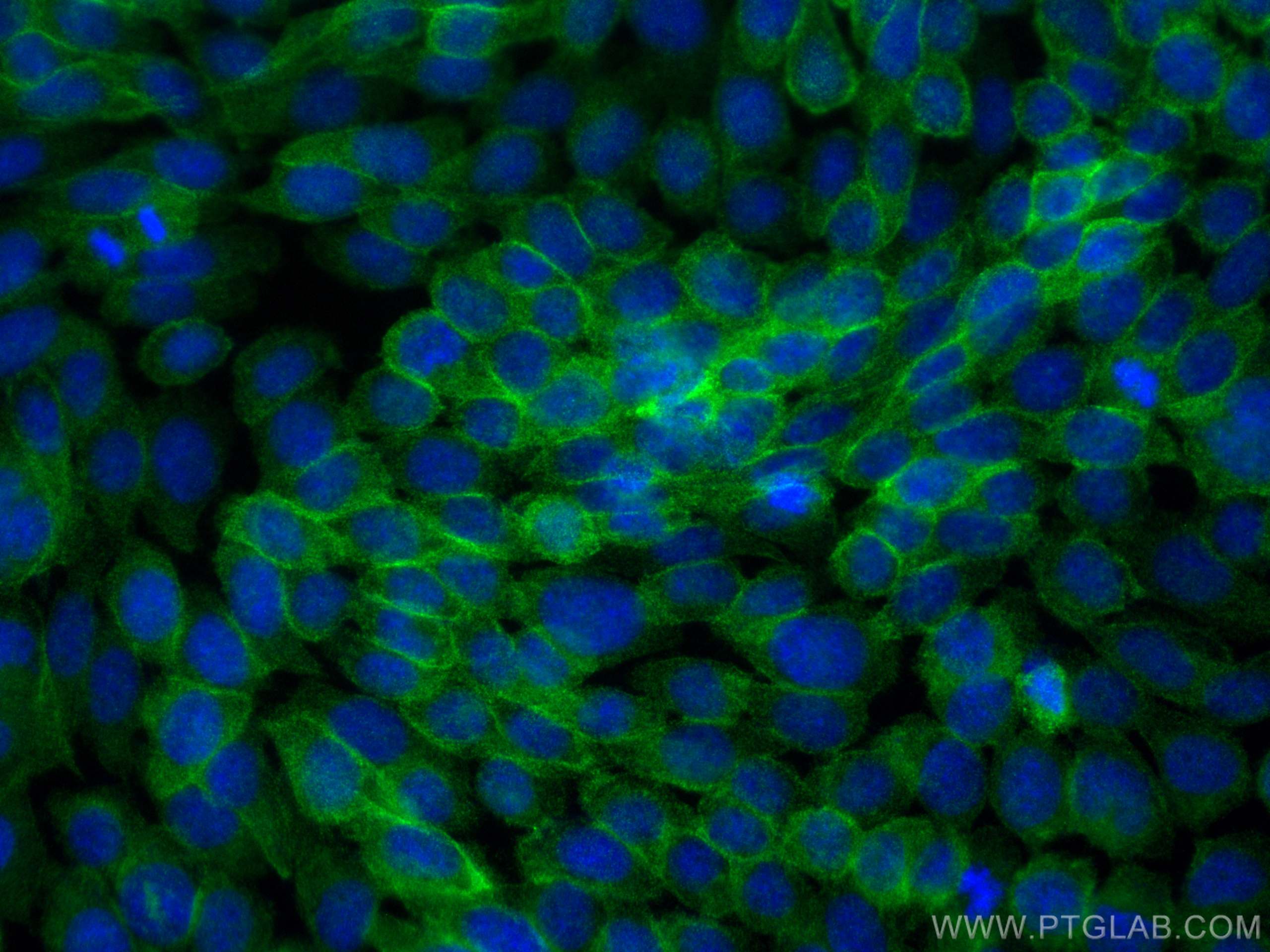 IF Staining of A431 using 83191-5-RR