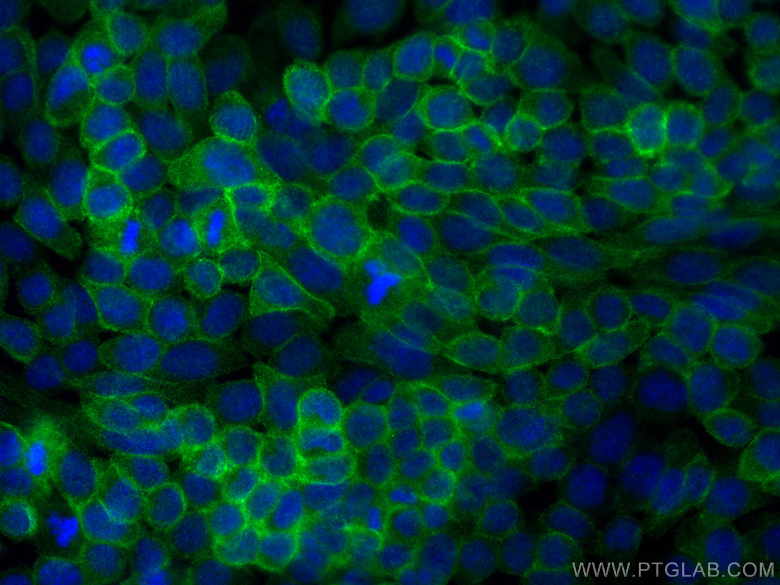 IF Staining of A431 using 83191-5-RR