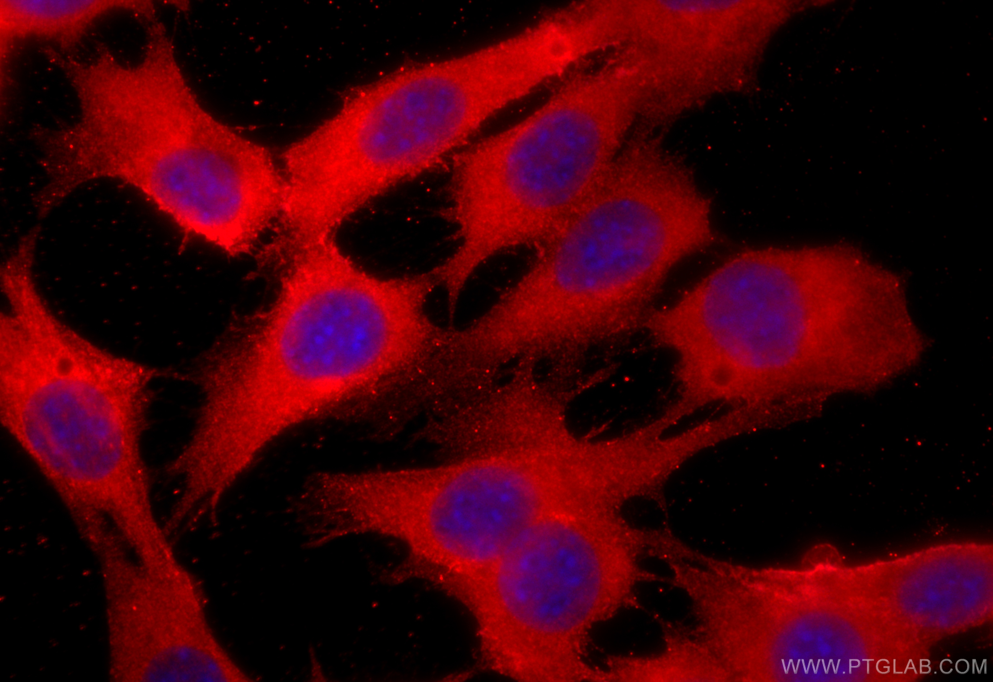 IF Staining of C2C12 using 16836-1-AP