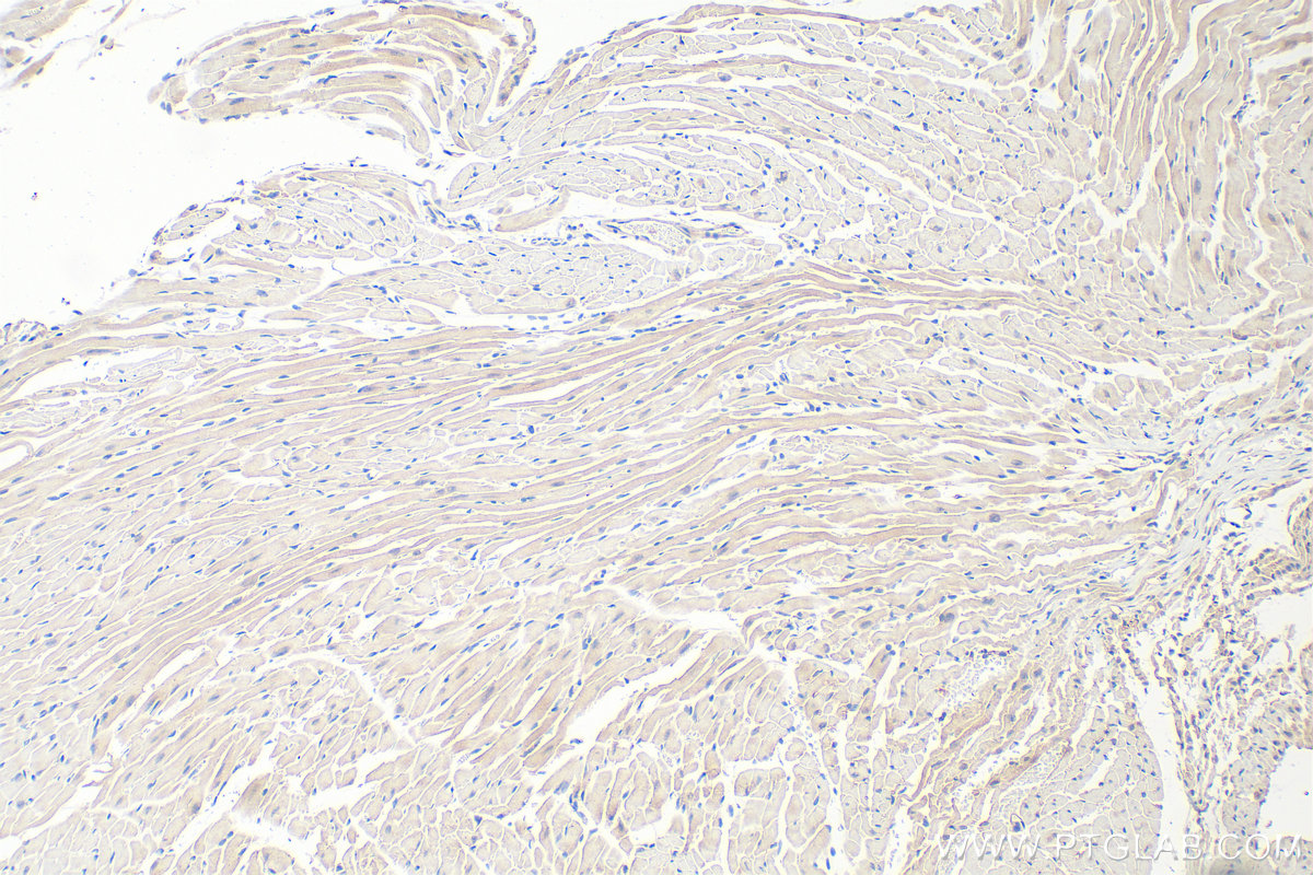 IHC staining of mouse heart using 55179-1-AP