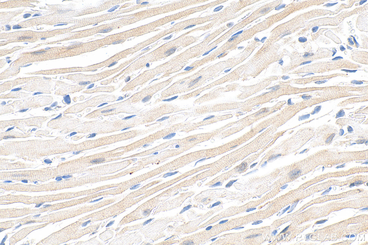 IHC staining of mouse heart using 55179-1-AP