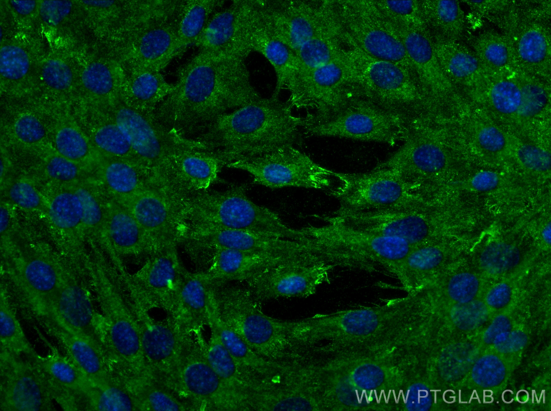 IF Staining of C2C12 using 68505-1-Ig