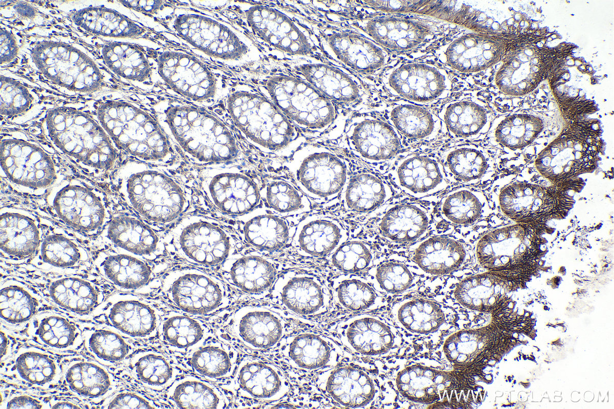 IHC staining of human colon using 67554-1-Ig