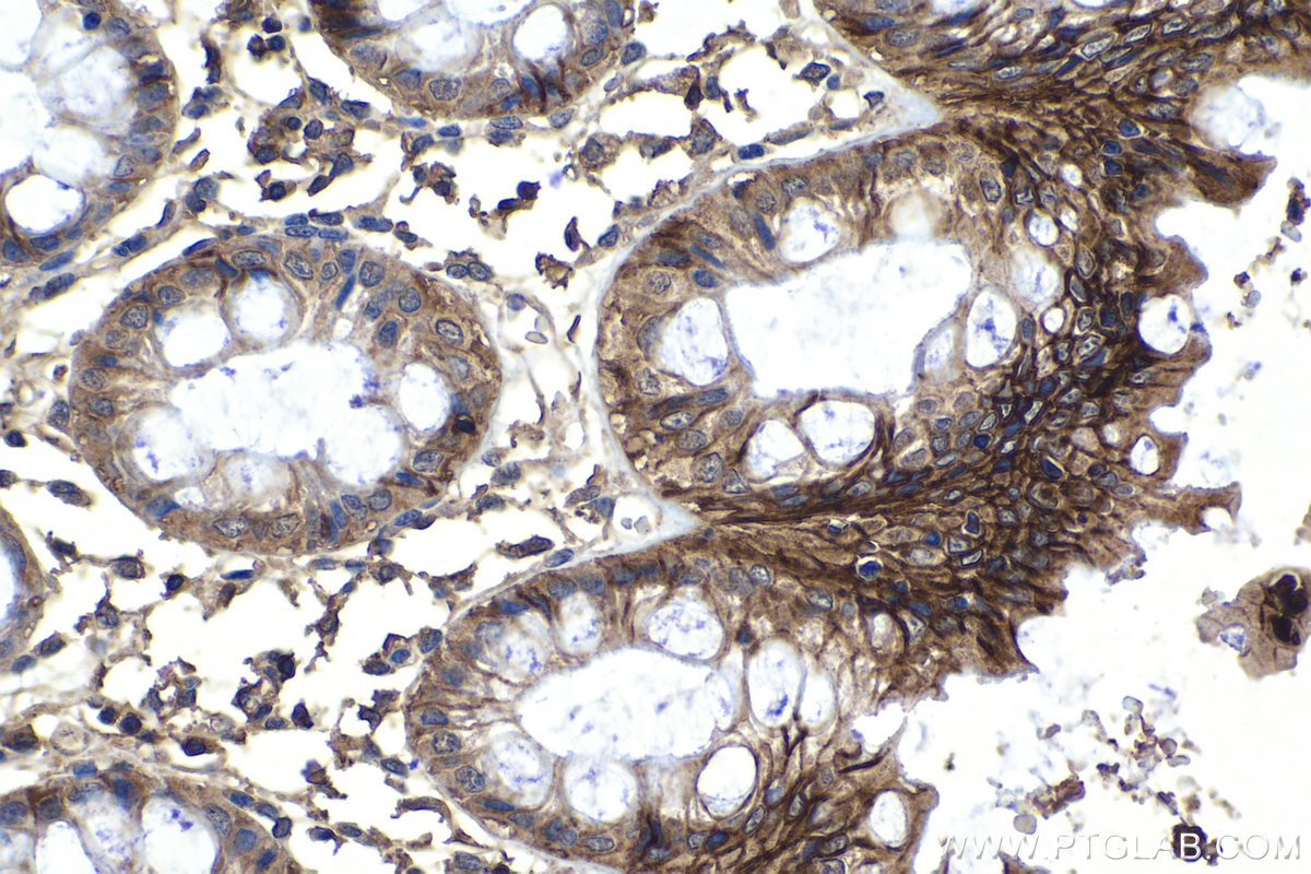 IHC staining of human colon using 67554-1-Ig