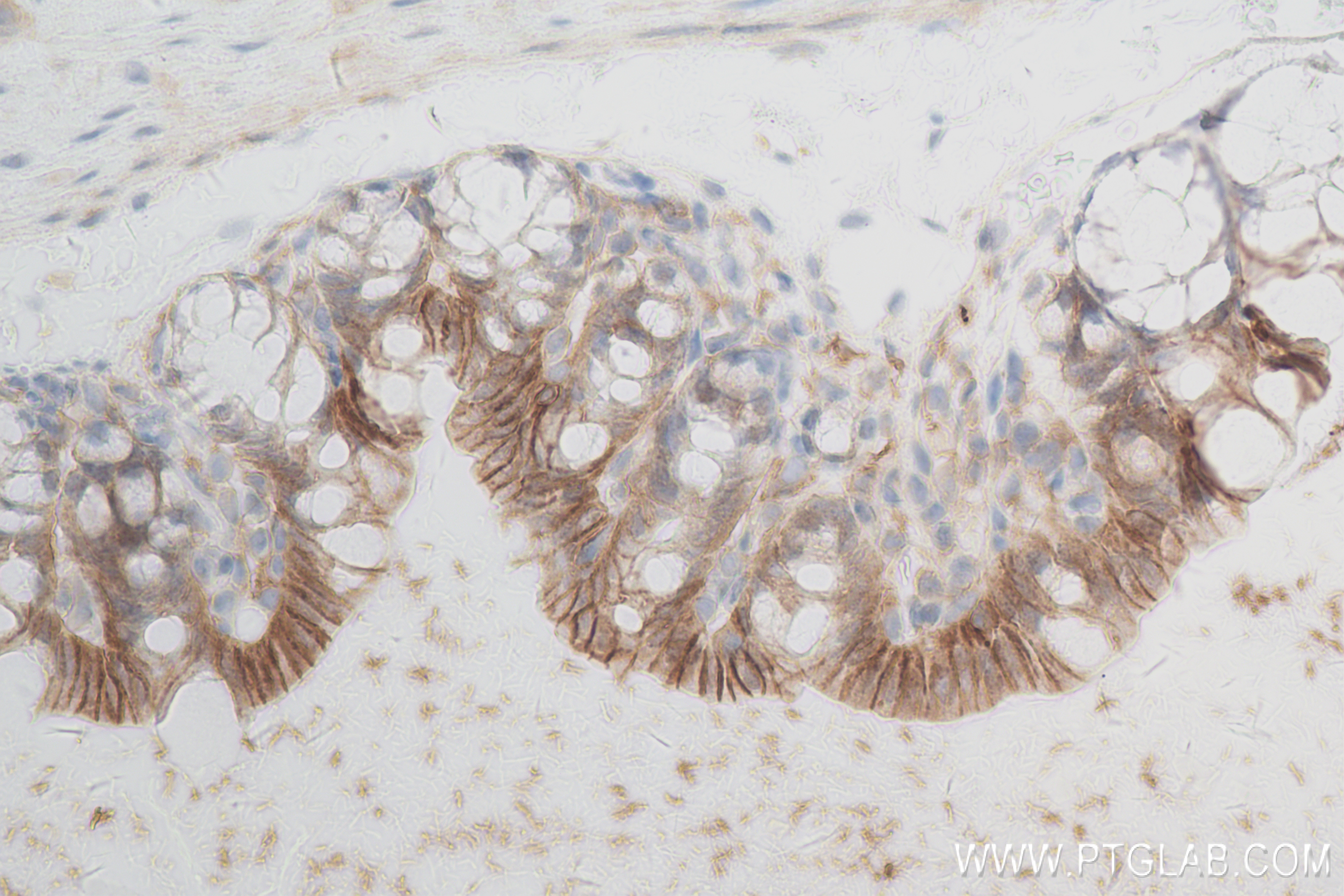 IHC staining of mouse small intestine using 83827-3-RR