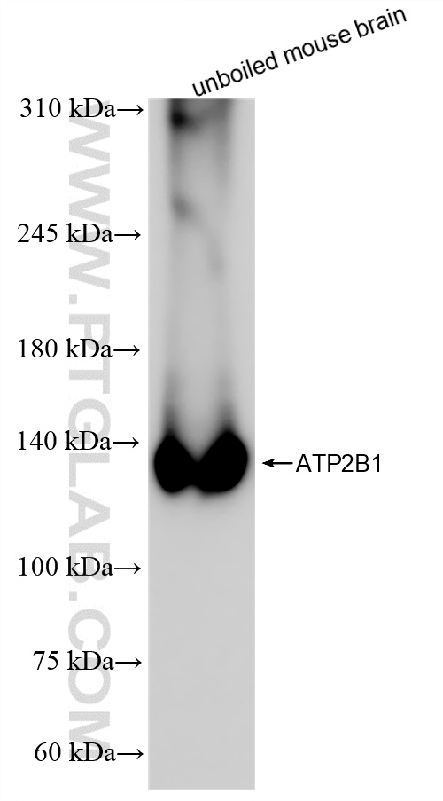 WB analysis of mouse brain using 83827-3-RR