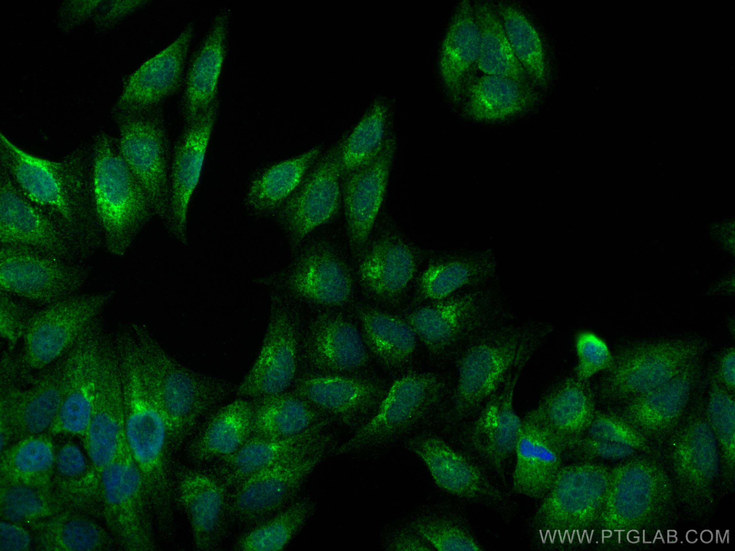 IF Staining of HepG2 using 13310-1-AP