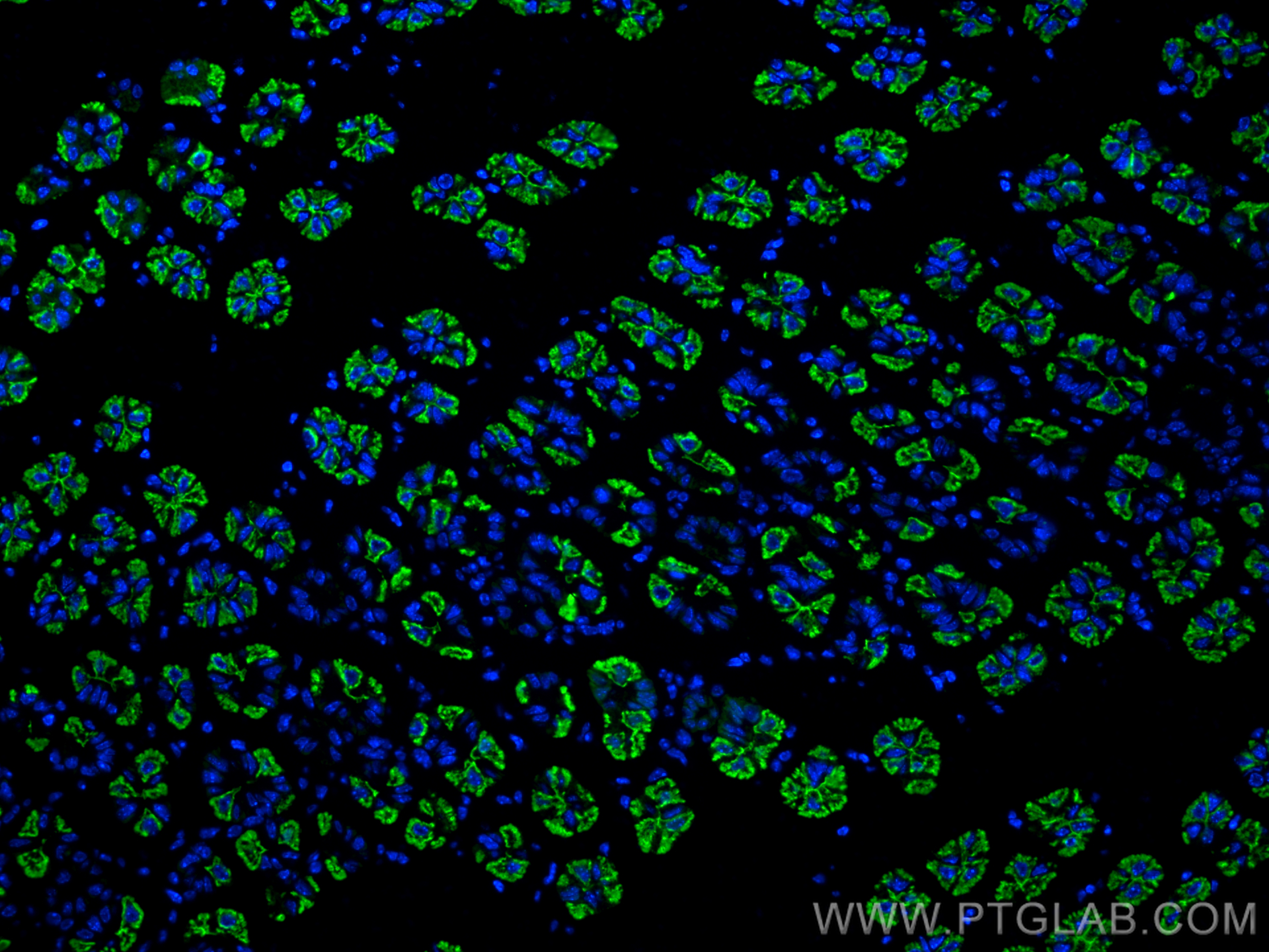 IF Staining of mouse stomach using 18692-1-AP