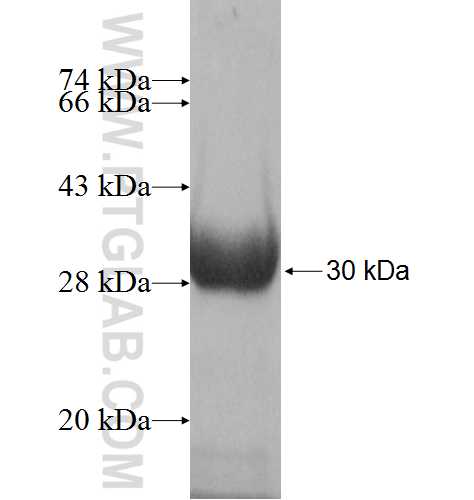 ATP4B fusion protein Ag6935 SDS-PAGE