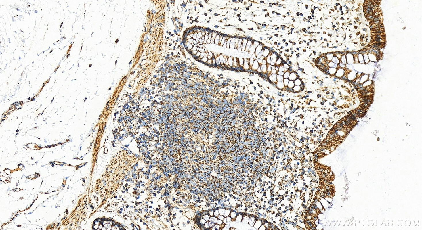 IHC staining of human colon using 14676-1-AP