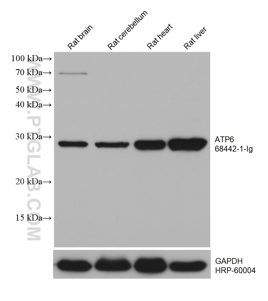 ATP6