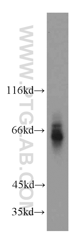 WB analysis of mouse kidney using 15305-1-AP