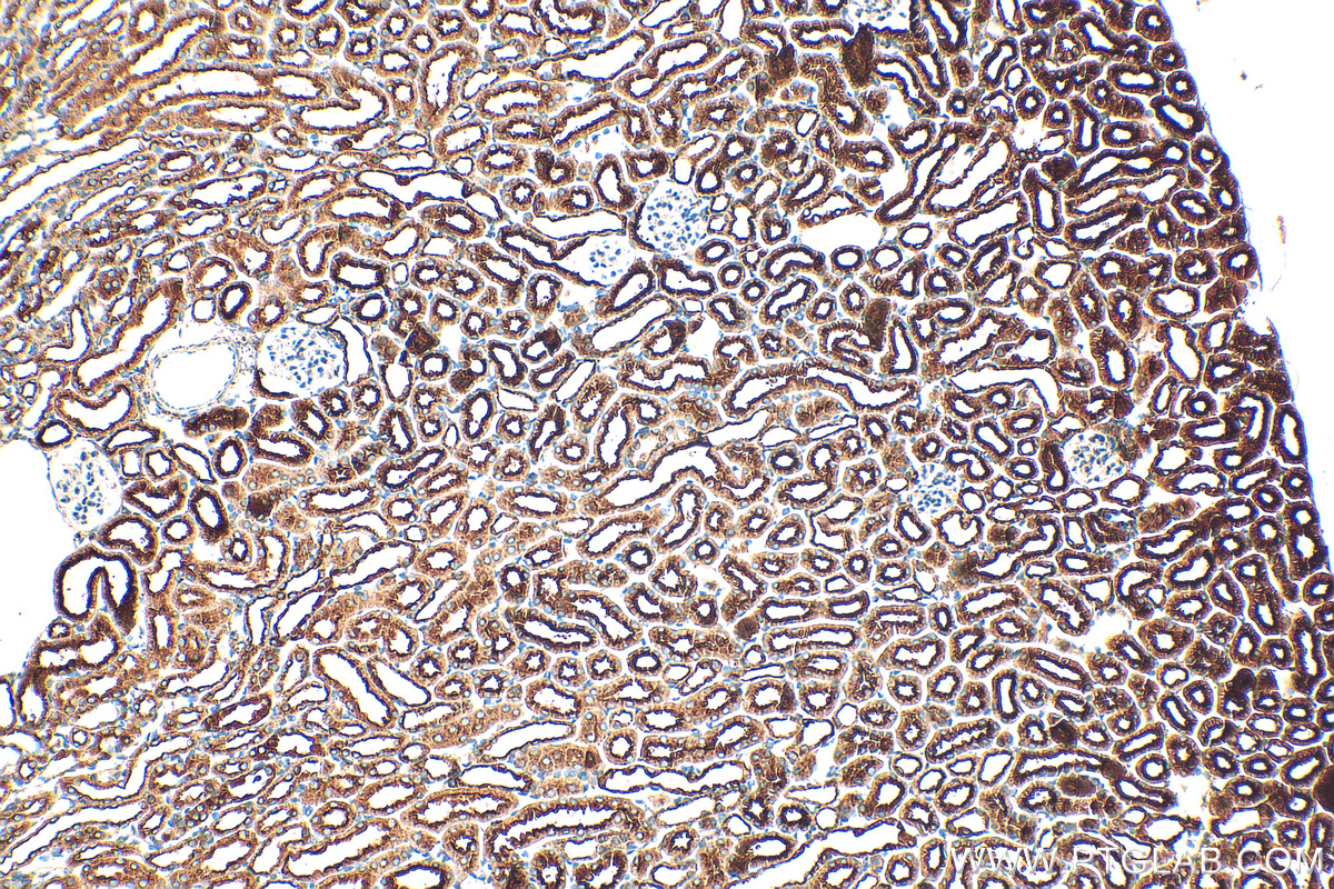 IHC staining of mouse kidney using 18274-1-AP