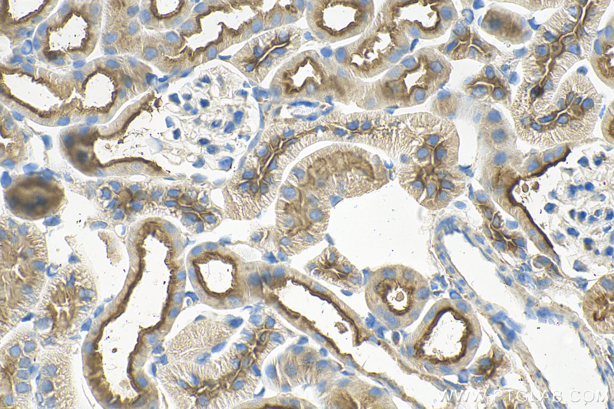 IHC staining of mouse kidney using 68506-1-Ig (same clone as 68506-1-PBS)