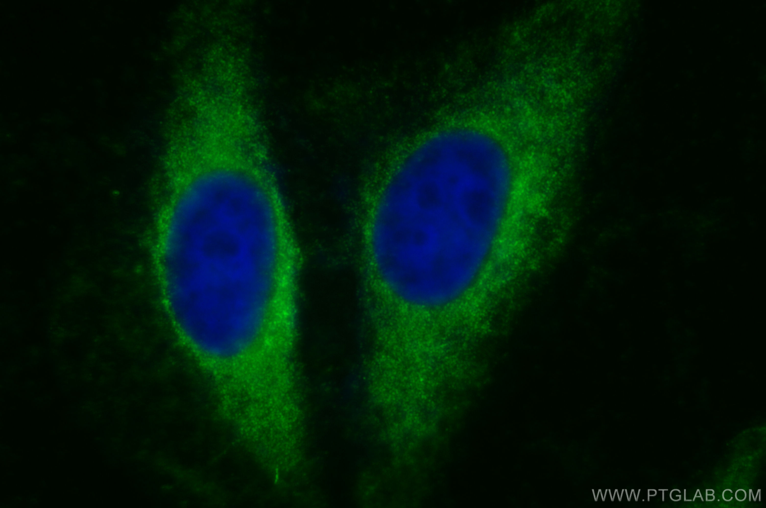 IF Staining of HeLa using 17115-1-AP