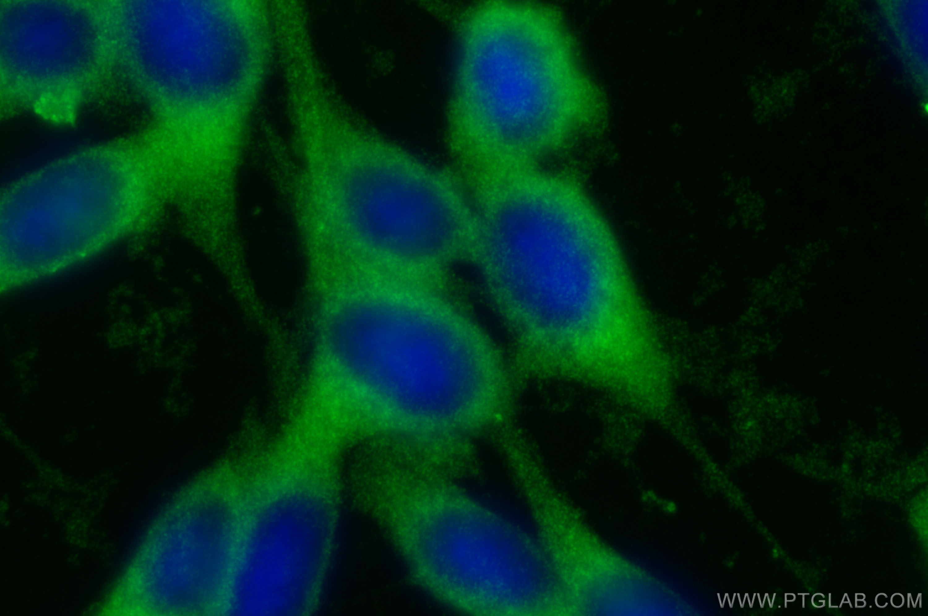 IF Staining of NIH/3T3 using 17115-1-AP