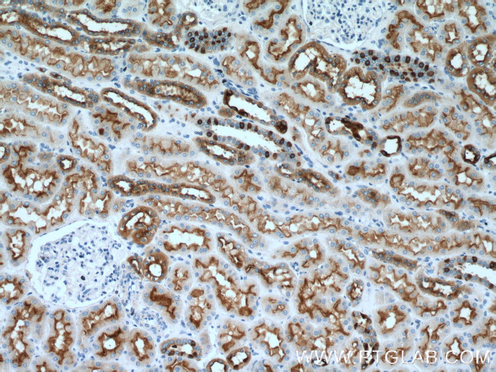 IHC staining of human kidney using 14780-1-AP