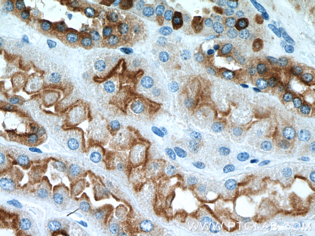 IHC staining of human kidney using 14780-1-AP