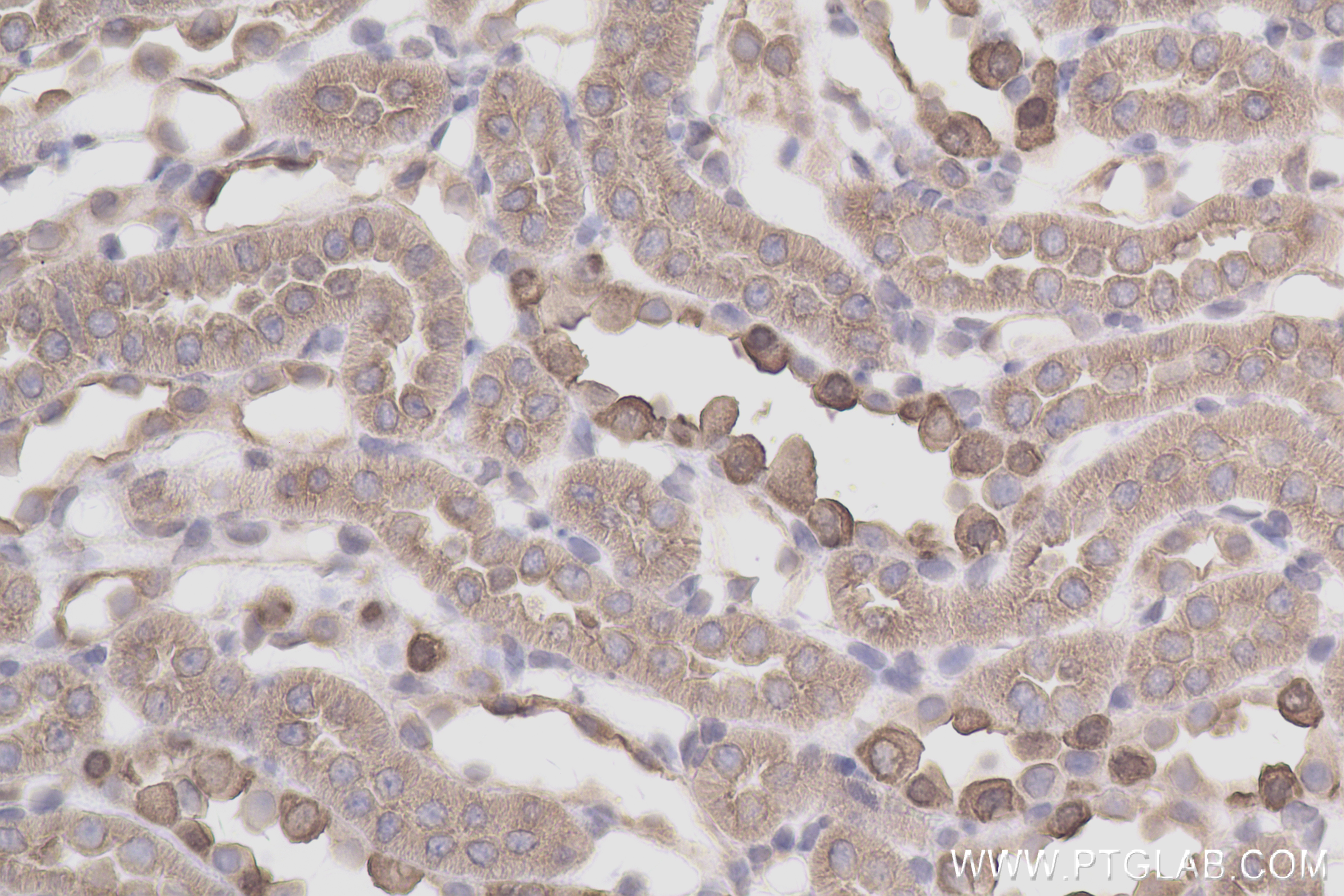 IHC staining of rat kidney using 83953-5-RR (same clone as 83953-5-PBS)