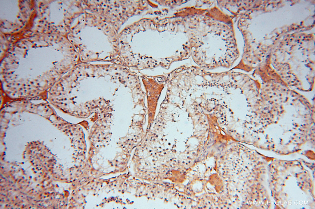 IHC staining of human testis using 16274-1-AP