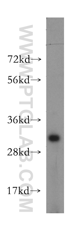 WB analysis of mouse brain using 13235-1-AP