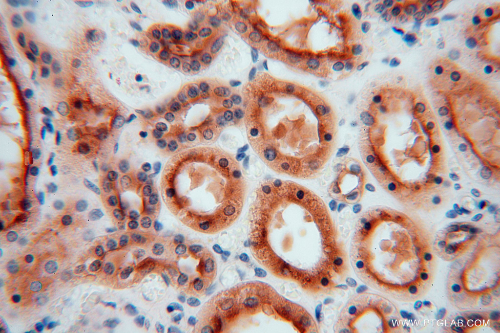 IHC staining of human kidney using 16143-1-AP