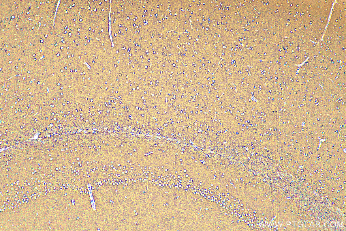 IHC staining of mouse brain using 25316-1-AP