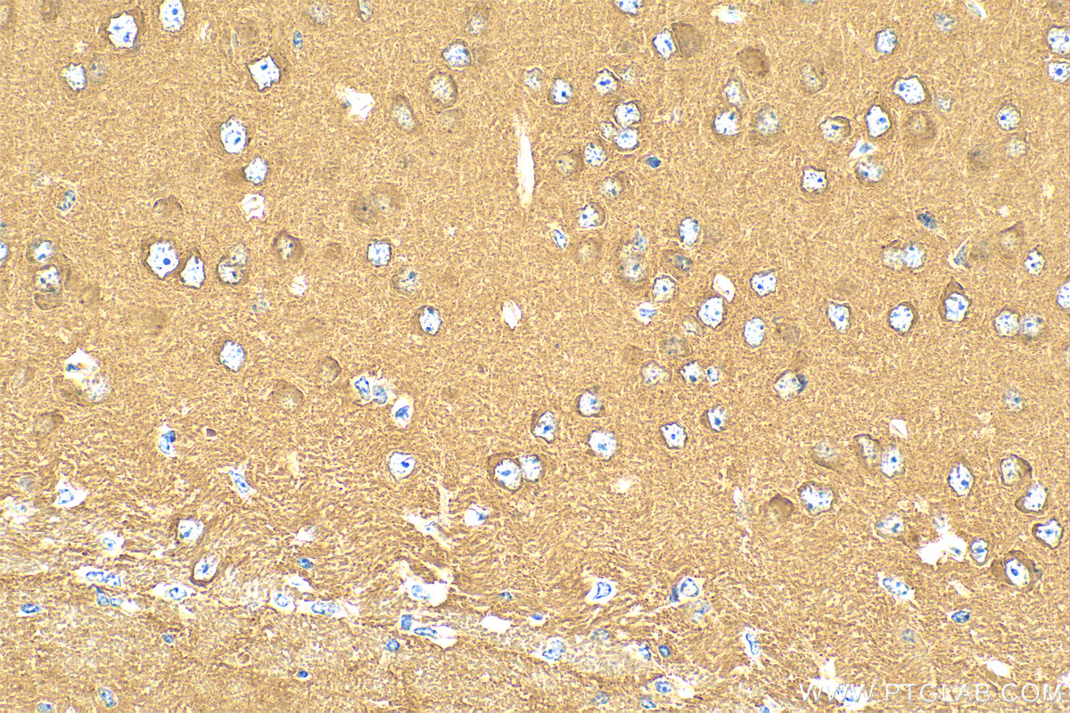 IHC staining of mouse brain using 25316-1-AP