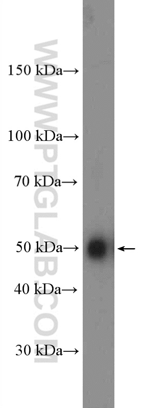 WB analysis of mouse brain using 26683-1-AP