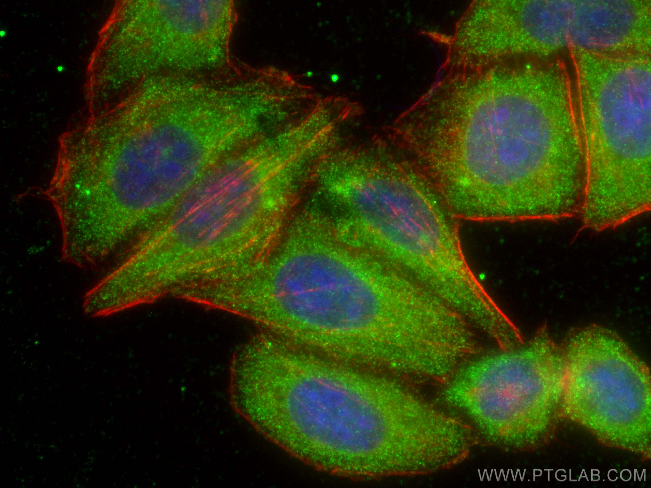 IF Staining of HepG2 using 68425-1-Ig (same clone as 68425-1-PBS)