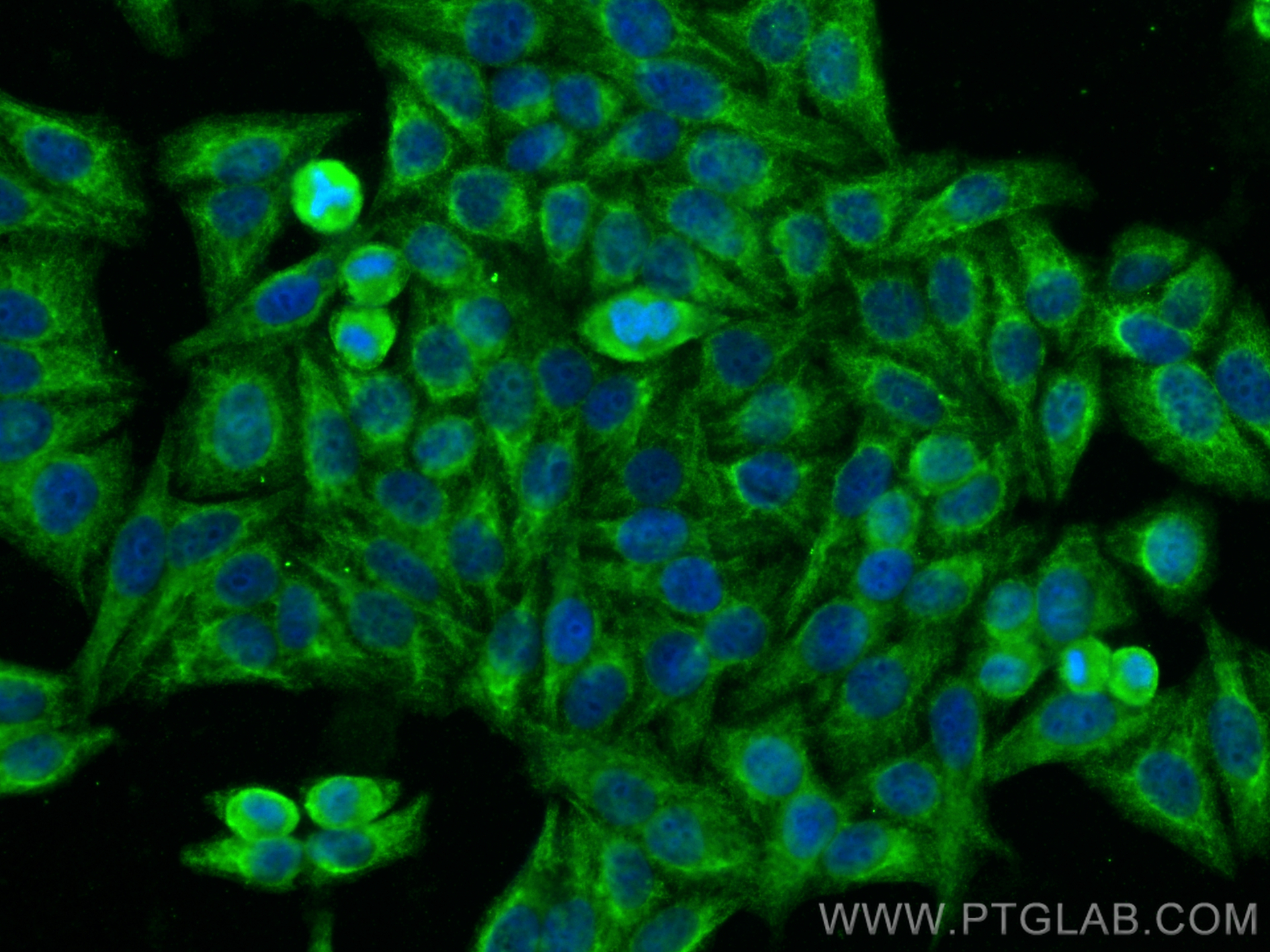 IF Staining of HepG2 using 19786-1-AP