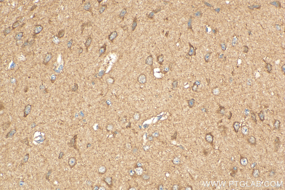 IHC staining of mouse brain using 31697-1-AP