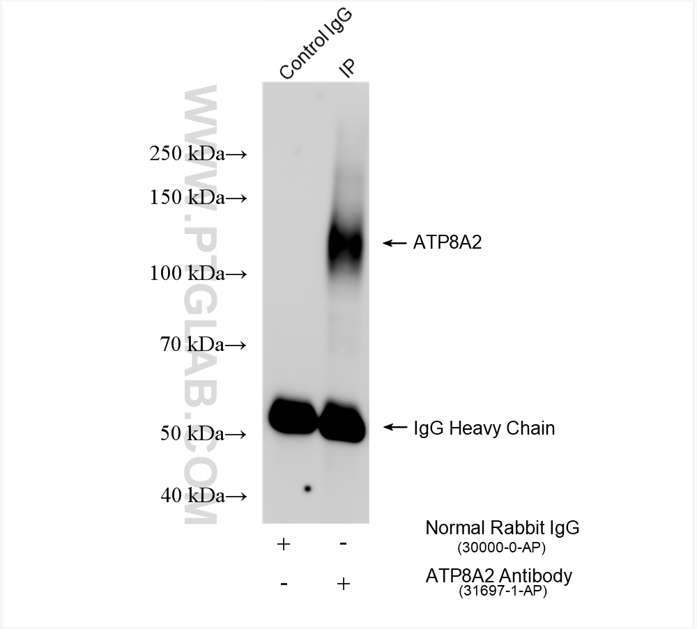 IP experiment of mouse testis using 31697-1-AP