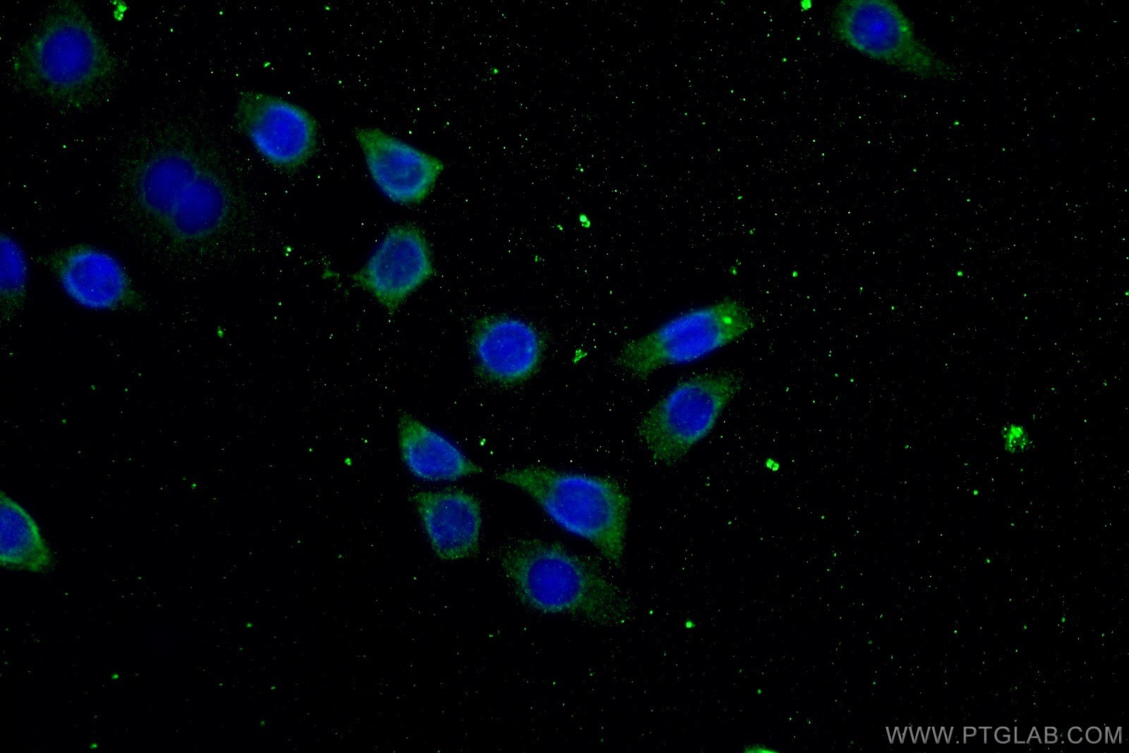 IF Staining of HeLa using 19504-1-AP