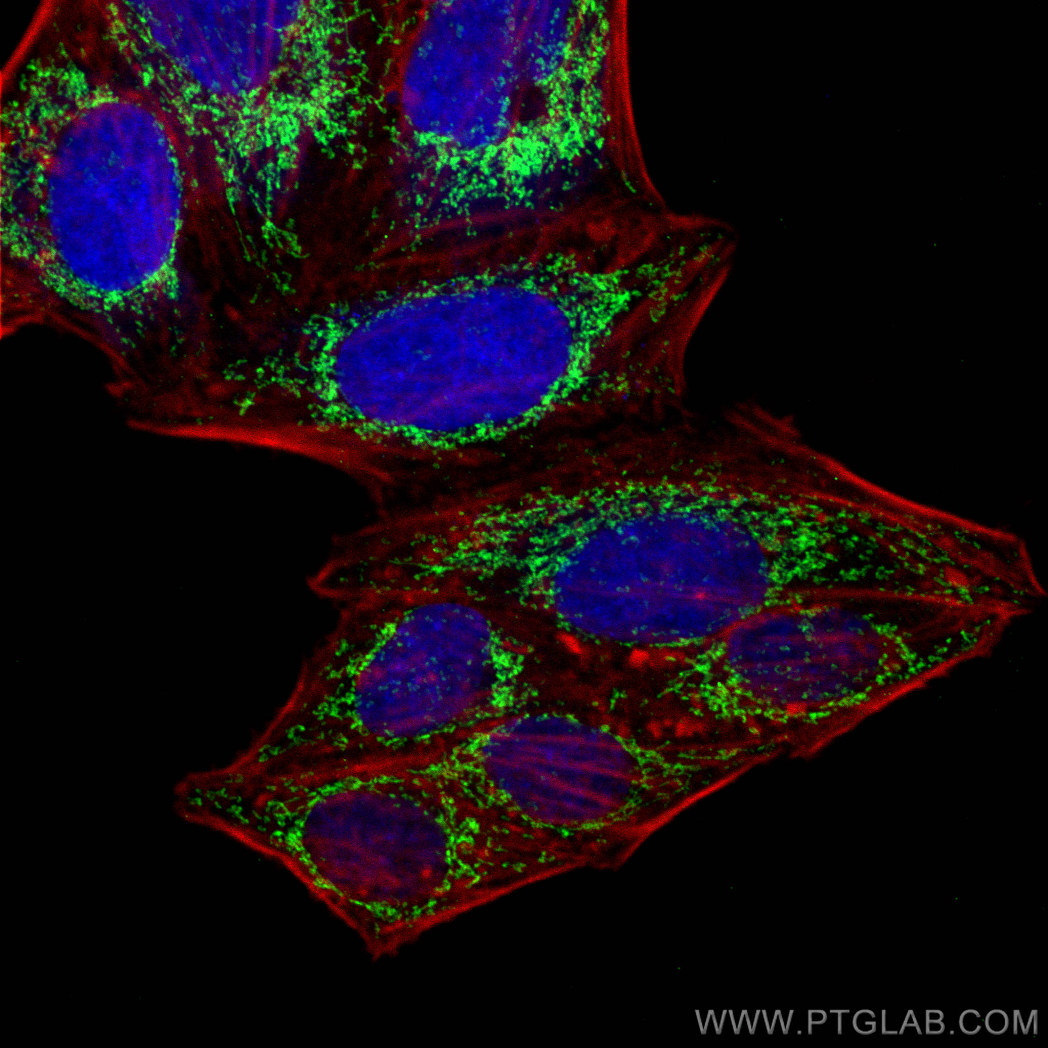 IF Staining of HepG2 using 17247-1-AP