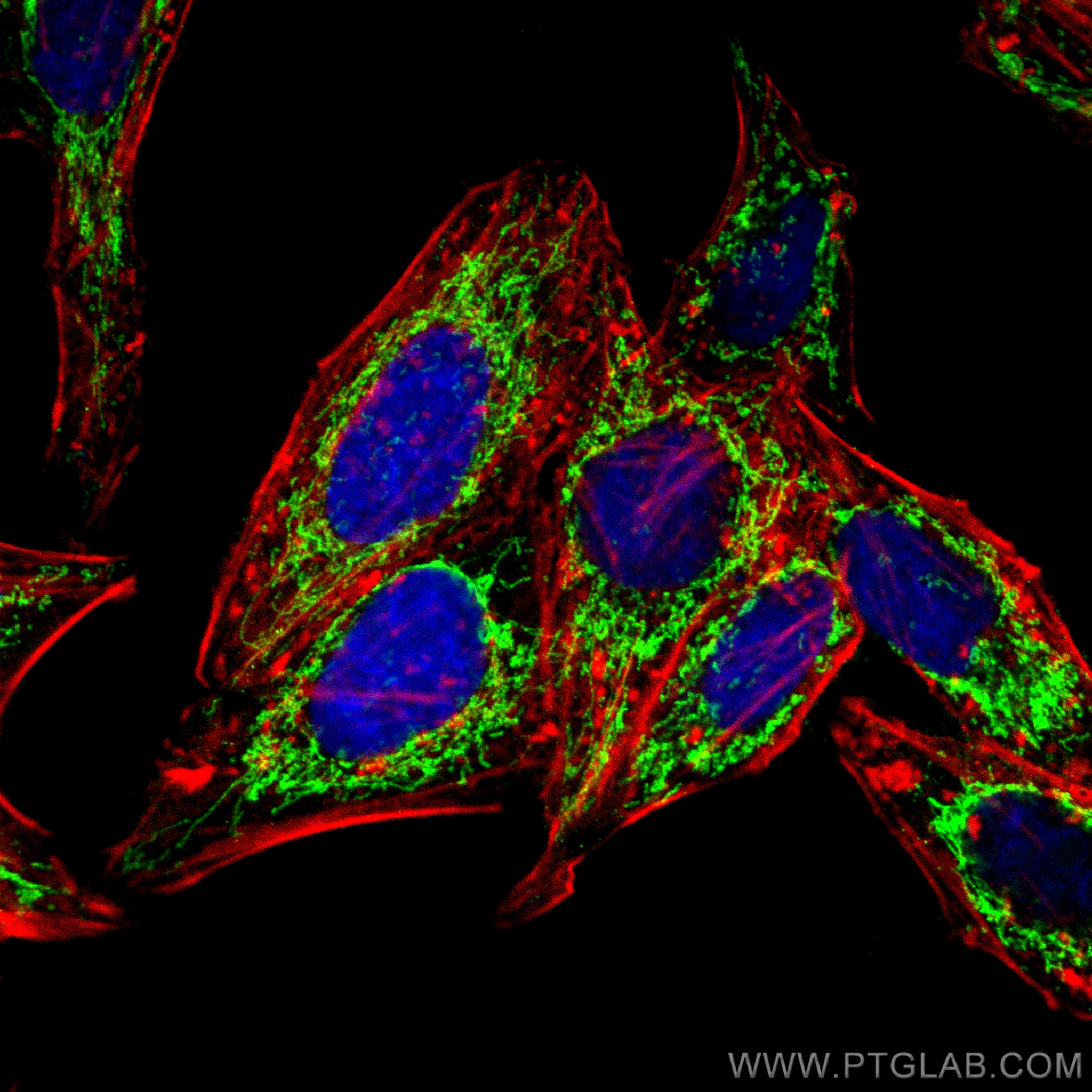 IF Staining of HepG2 using CL488-17247