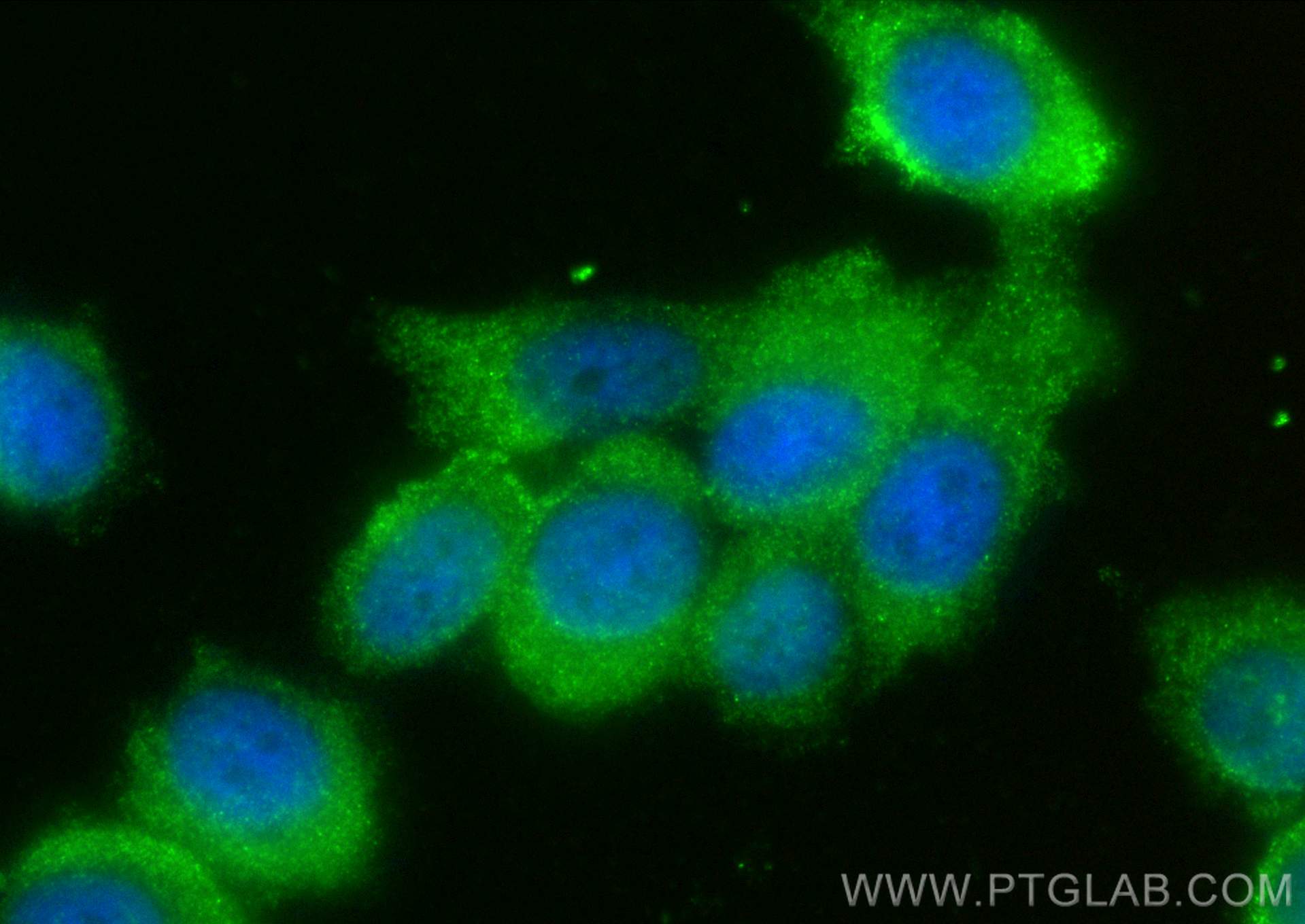 IF Staining of PC-3 using 31537-1-AP