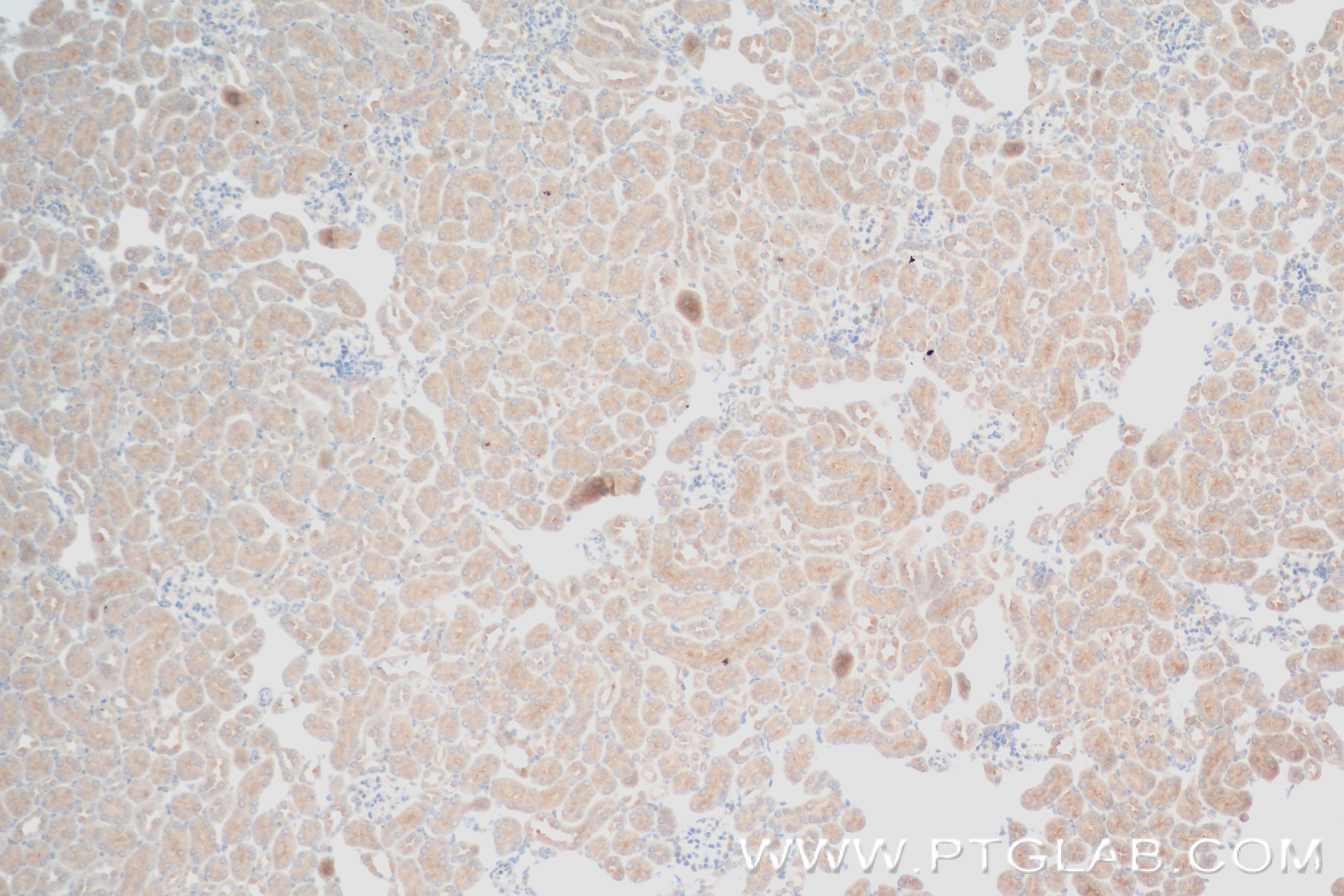 IHC staining of mouse kidney using 84318-4-RR